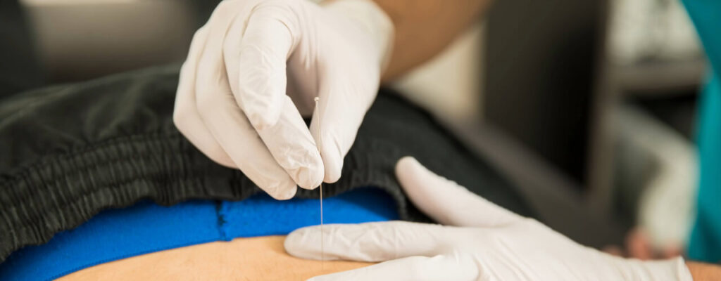 Is Dry Needling Safe? Exploring the Treatment’s Safety